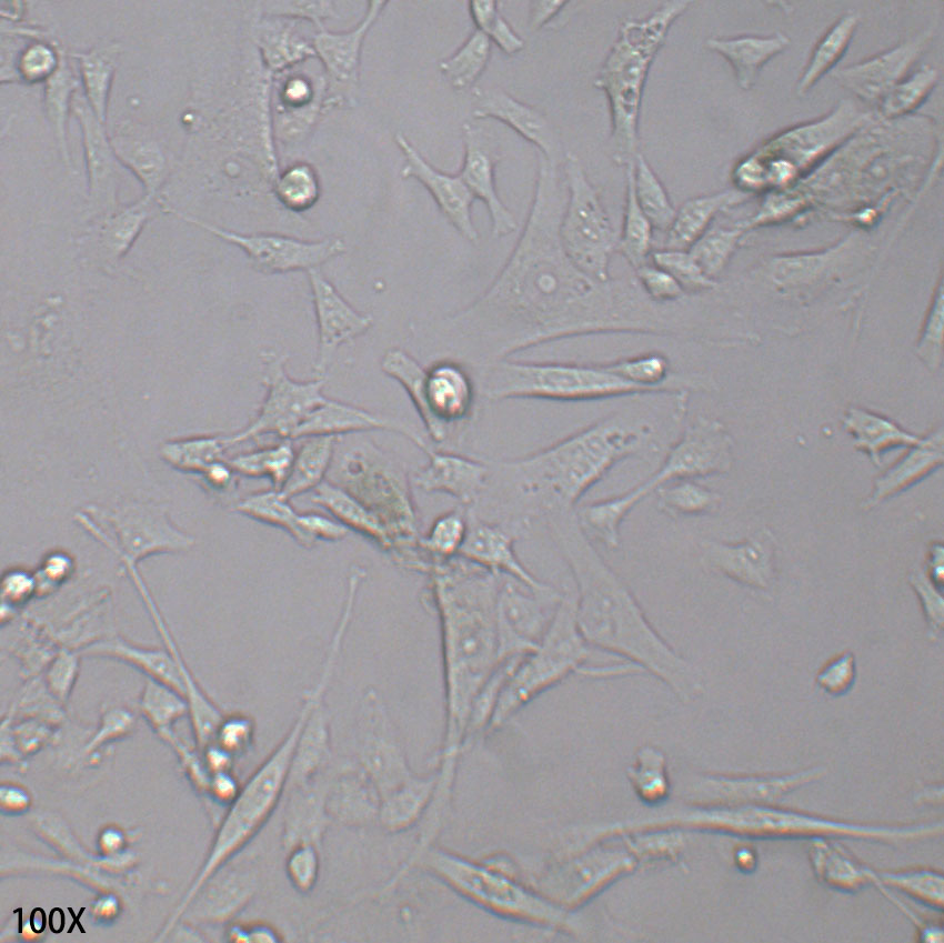 SK-HEP-1 人肝腹水腺癌细胞