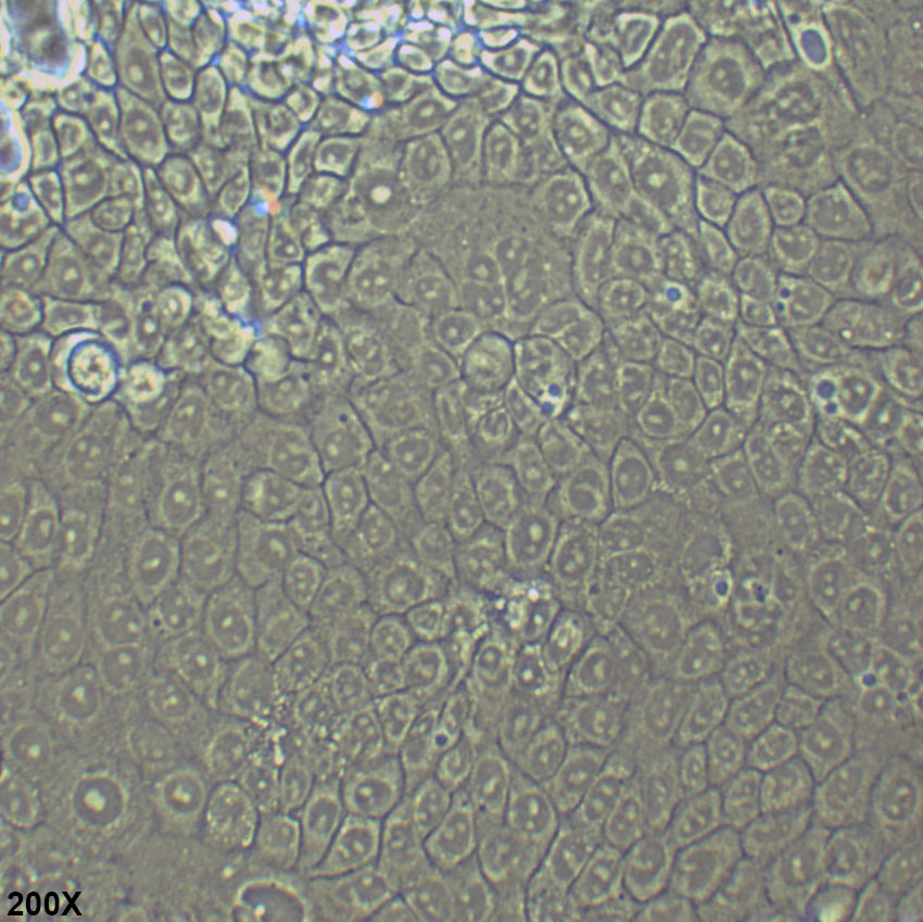 NCI-N87 人胃癌细胞