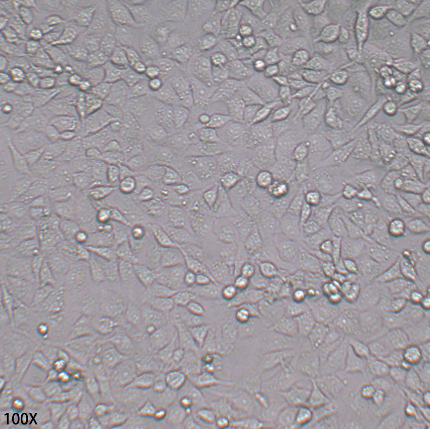 MDA-MB-231 人乳腺癌细胞